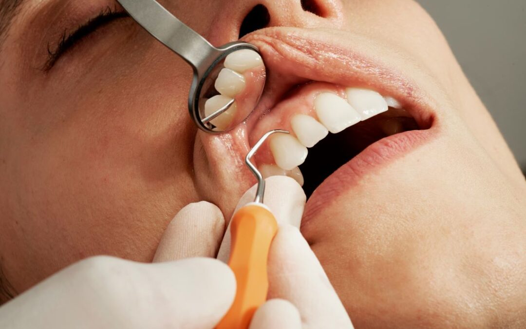Top 10 Surprising Advantages of Periodontal Care